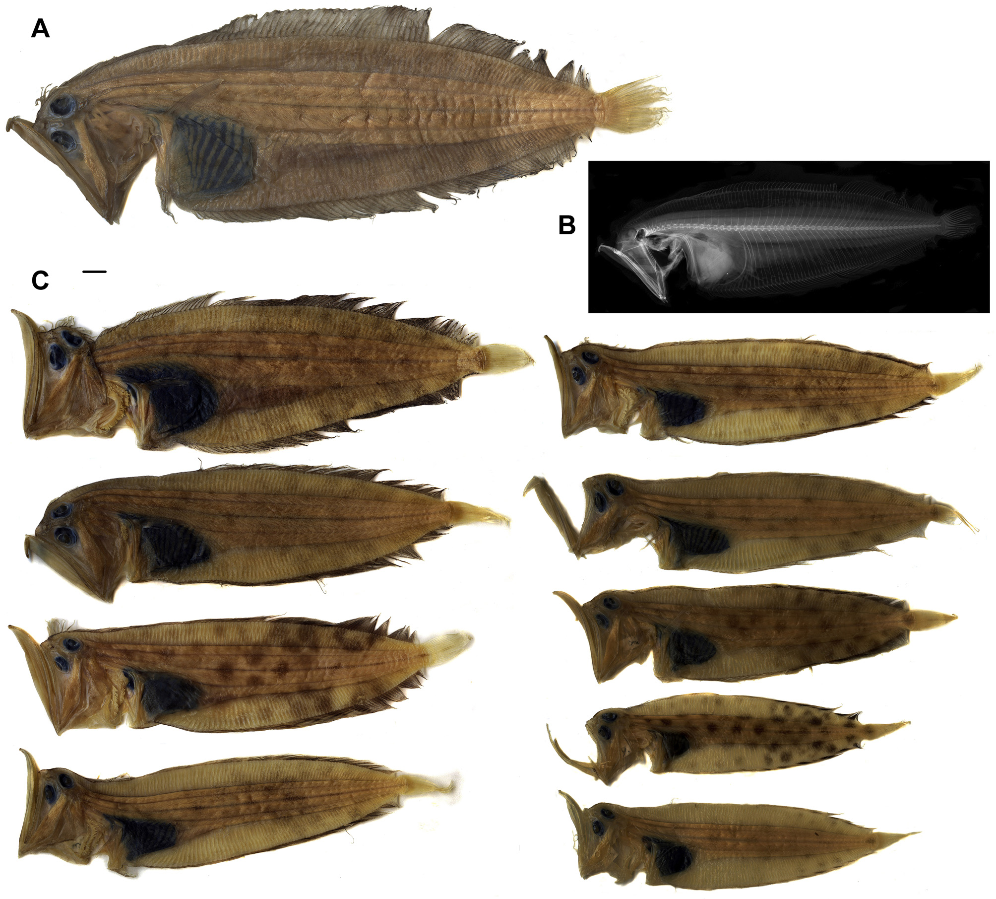 ภาพ ปลา megagnatha (Chascanopsetta megagnatha)