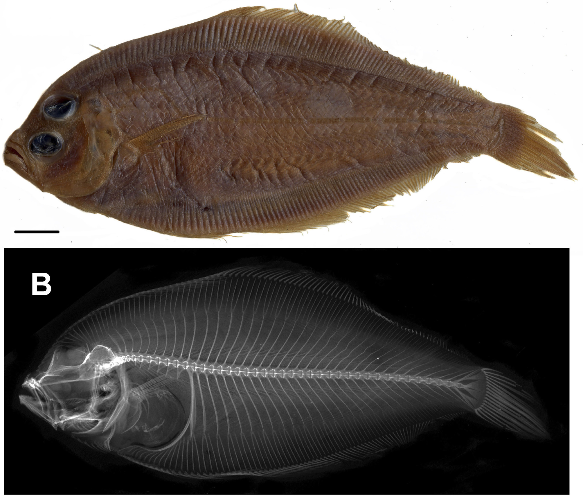 ภาพ ปลา amaokai (Parabothus amaokai)
