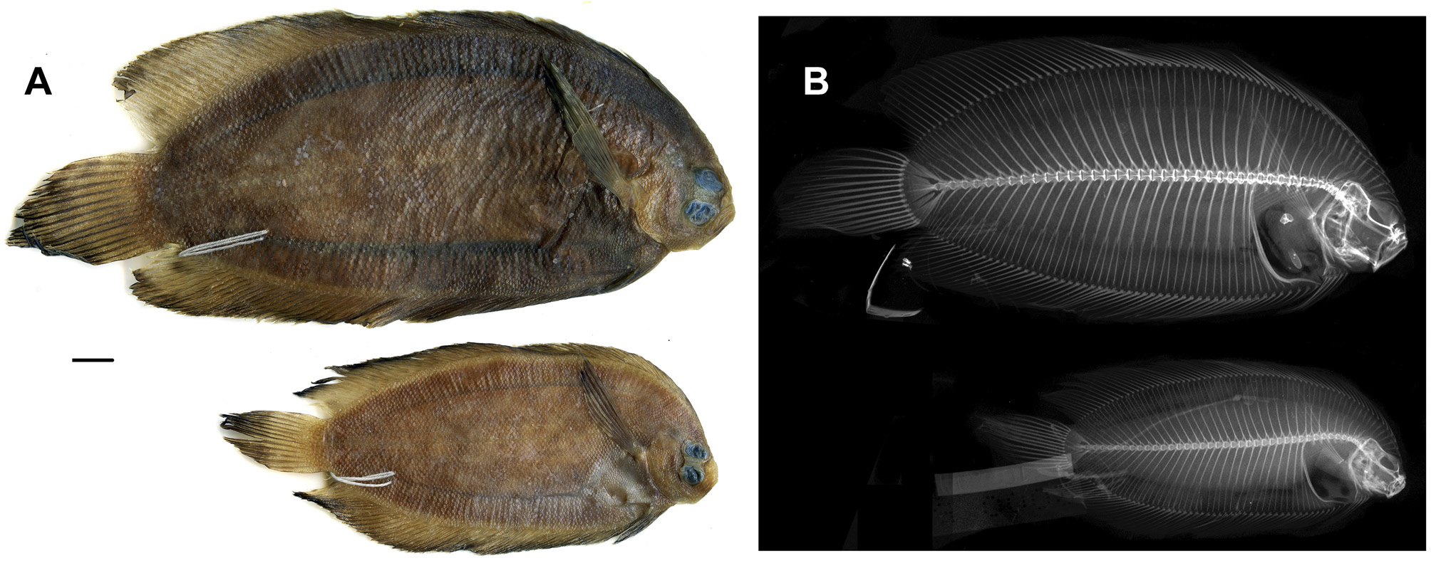 ภาพ ปลา stigmosa (Plagiopsetta stigmosa)